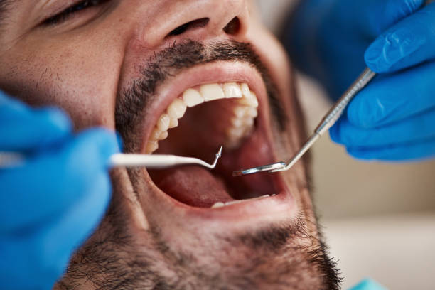 Best Emergency Broken Tooth Repair in Sandia Knolls, NM